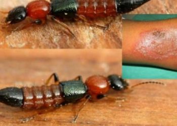 इलाममा पनि मा भेटिए ‘नाइरोबी फ्लाइ’ संक्रमित