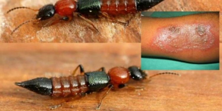 इलाममा पनि मा भेटिए ‘नाइरोबी फ्लाइ’ संक्रमित
